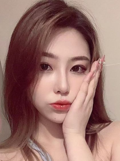 整形價格多少錢?做次整形到底需要多少錢?2022年全國整形價格表查詢?雙眼皮價格表?隆鼻價格表?吸脂價格表?(圖12) 整形價格多少錢?做次整形到底需要多少錢?2022年全國整形價格表查詢?雙眼皮價格表?隆鼻價格表?吸脂價格表?(圖12)