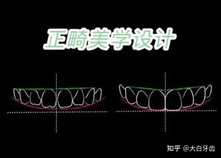 2022年成都十大牙齒矯正醫(yī)院排名，成都牙齒矯正哪里性價(jià)比最高？成都牙齒矯正價(jià)格表！(圖5)
