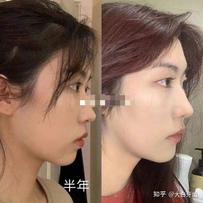 2022年成都十大牙齒矯正醫(yī)院排名，成都牙齒矯正哪里性價(jià)比最高？成都牙齒矯正價(jià)格表！(圖9)
