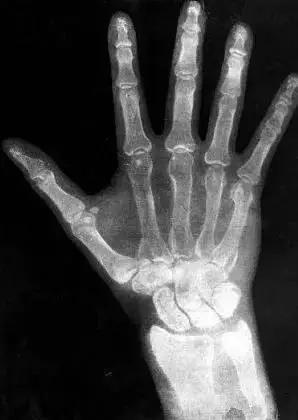 世界科學史十大“最意外發明”(圖3) 世界科學史十大“最意外發明”(圖3)