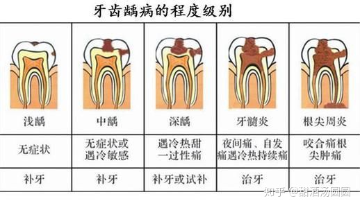 我在長沙市口腔醫(yī)院補(bǔ)牙全過程及經(jīng)驗(yàn)分享(圖6) 我在長沙市口腔醫(yī)院補(bǔ)牙全過程及經(jīng)驗(yàn)分享(圖6)